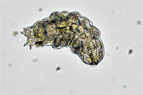  Cryptosporidium! A Tiny Parasite That Can Cause Big Trouble