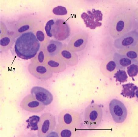  Leucocytozoon!  A Tiny Terror Hiding Within the Bloodstream