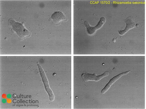  Rhizamoeba: This Unicellular Masterpiece Is More Than Just a Blob!